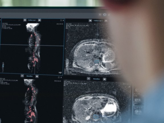 Software für die Radiologie mint Lesion™ zeigt Bilder aus verschiedenen Quellen an.
