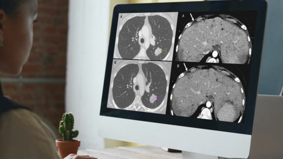 Eine Person schaut sich MRI und CT Scans am Computer an