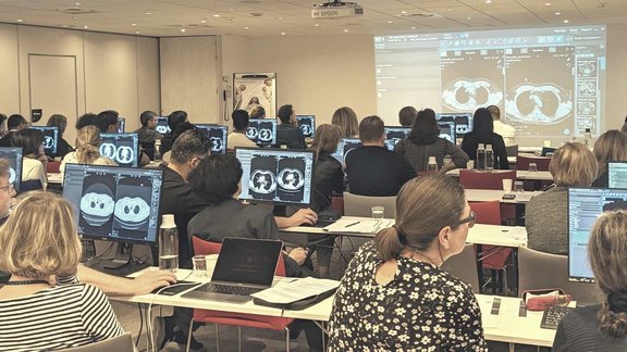 Personen in einem Workshop. Die Computerbildschirme zeigen die Nutzungsoberfläche von mint Lesion™  und verschiedene MRT Scans.