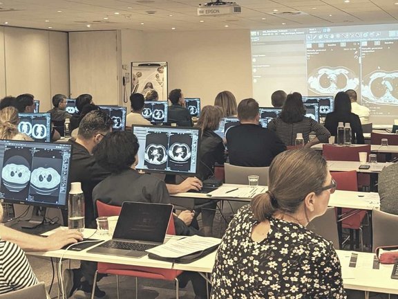 People in a workshop. The computer screens show the user interface of mint Lesion™ and various MRI scans.