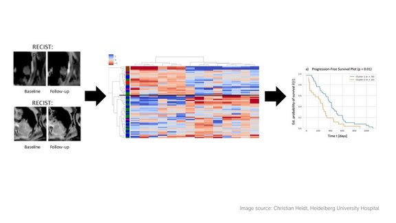 Bild zeigt als grafischen Abstrakt Bilder aus der Studie, von MRT Aufnahmen bis zur Auswertung der Delta-Radiomics-Texturmerkmale