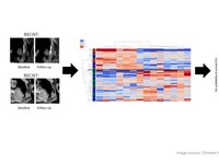 The image serves as a graphical abstract, displaying visuals from the study, ranging from MRI scans to the analysis of delta-radiomics texture features