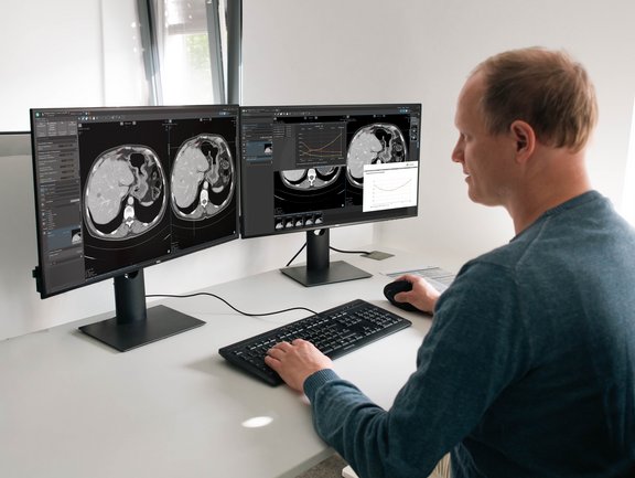 Standardized response criteria evaluation in mint Lesion featuring the TGRM module.