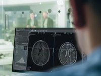 Ein Bild von einer Person, die einen Gehirnscan auf der Programmoberfläche von mint Lesion™ auf einem Computer betrachtet