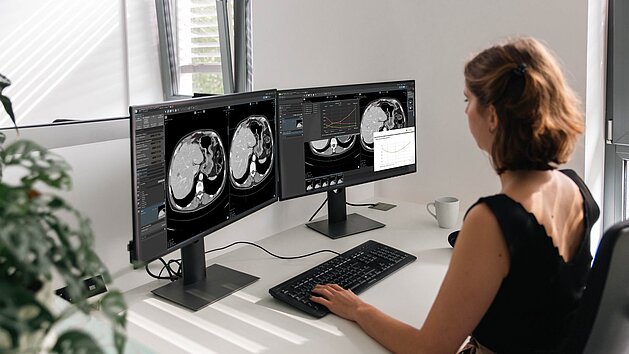 mint Lesion usage during a clinical trial read, featuring the TGRM export tool.