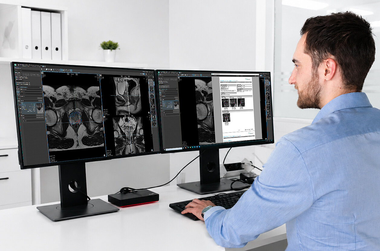 Interdisziplinärer Workflow für die Prostatakarzinom-Diagnostik mit strukturierter MRT-Befundung, MRT-/Ultraschall-Fusionsbiopsie, Pathologieintegration und longitudinalem Patientenmanagement in mint Lesion.