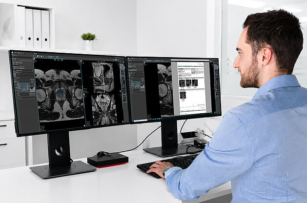 Integrated prostate cancer workflow connecting radiology, urology, and pathology through structured reporting, MRI-guided biopsy, longitudinal follow-up, and AI-supported analysis.