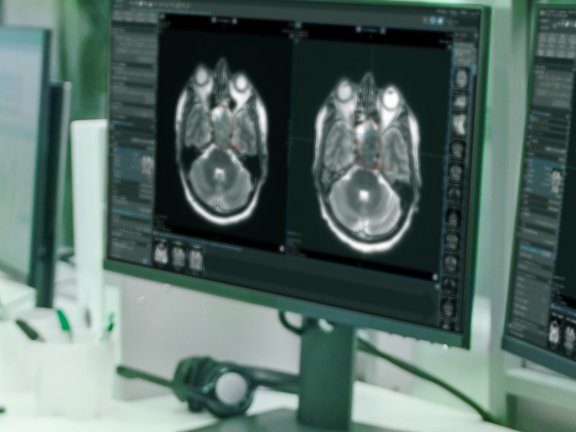 Der Radiologe betrachtet die PET-Bilder und den Befundbericht (TNM-8) für Kopf- und Halskrebs, der in mint Lesion™ erstellt wurde.