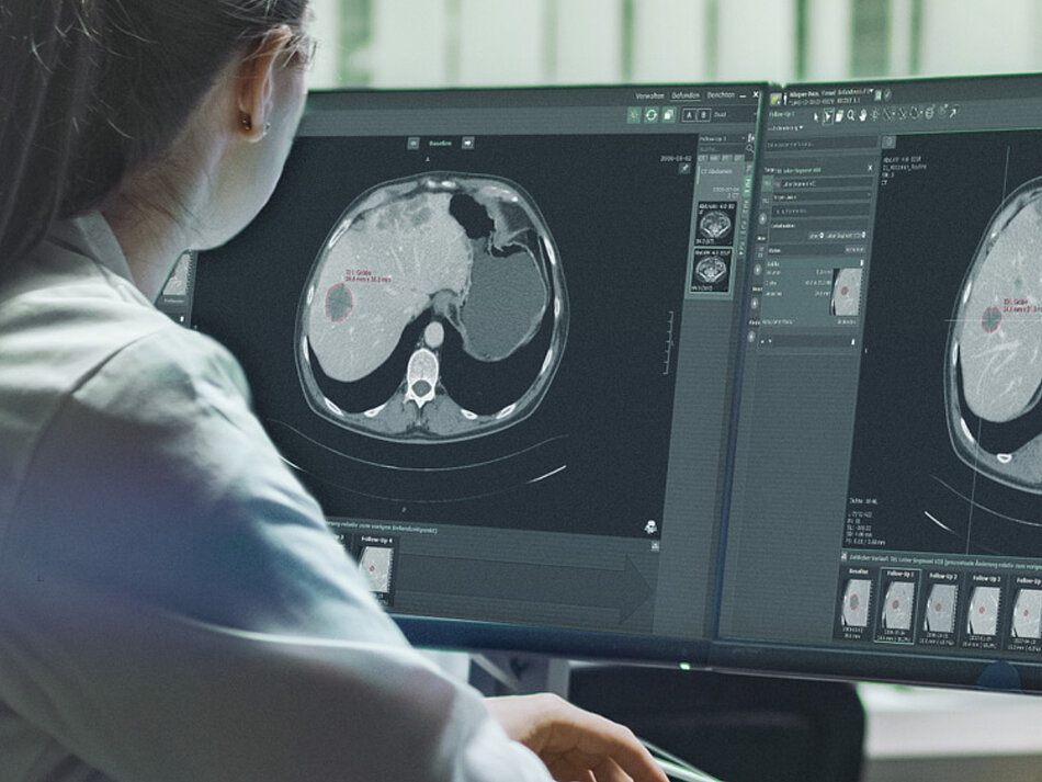 Eine Radiologin führt im Rahmen einer klinischen Studie mit mint Lesion™ eine Mehrfachzeitpunkt-Bewertung eines Leberkrebsfalls durch.