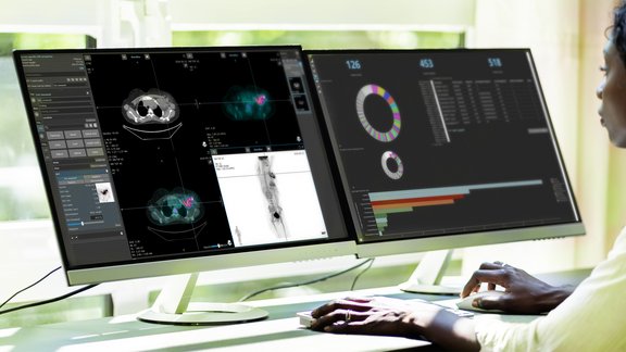 Radiologe liest PET-Bilder eines Krebspatienten und erstellt mit mint Lesion™ Bildgebungsdaten und Daten der klinischen Studie in Echtzeit