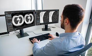 Radiologist using mint Lesion for structured lung cancer screening reporting and AI-assisted lung nodule assessment