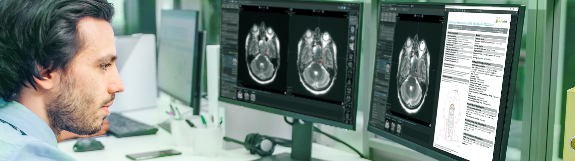 Der Radiologe betrachtet die PET-Bilder und den Befundbericht (TNM-8) für Kopf- und Halskrebs, der in mint Lesion™ erstellt wurde.