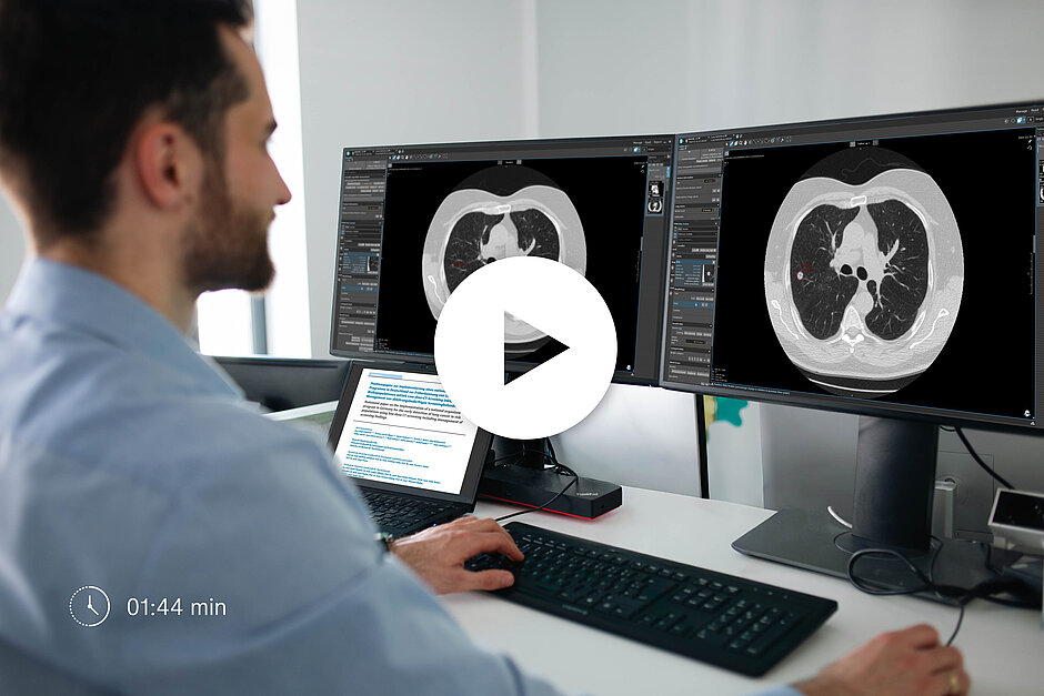 Radiologe bei der Auswertung eines Falls eines Teilnehmers an einer Lungenkrebsvorsorgeuntersuchung in Mint Lesion
