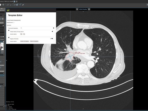A screenshot of the new extension in mint Lesion™: the Template Editor