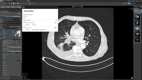 A screenshot of the new extension in mint Lesion™: the Template Editor