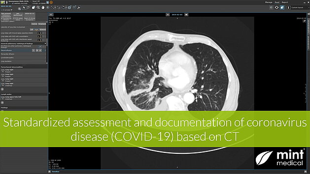 [Translate to German:] 