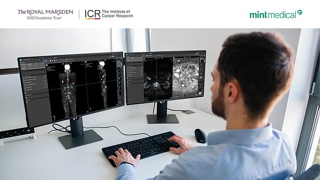 [Translate to German:] Radiologist reviewing whole-body MRI images with AI-supported tumor burden quantification for bone metastases and multiple myeloma using mint Lesion.
