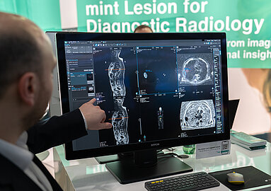 Radiologe analysiert Ganzkörper-MRT-Aufnahmen eines Multiplen Myeloms mit KI-gestützter Quantifizierung in mint Lesion