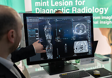 Radiologist analyzing whole-body MRI scans of multiple myeloma using AI-assisted quantification in mint Lesion