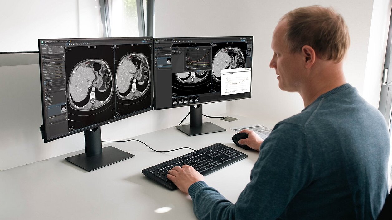 Standardized response criteria evaluation in mint Lesion featuring the TGRM module.