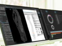 A computer screen shows the user interface of mint Lesion™  on which the analytical evaluation of a scan can be seen