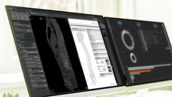 A computer screen shows the user interface of mint Lesion™  on which the analytical evaluation of a scan can be seen