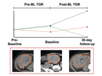 A diagram and a CT scan visualizing tumor growth rate in patients with refractory or relapsed lymphoma
