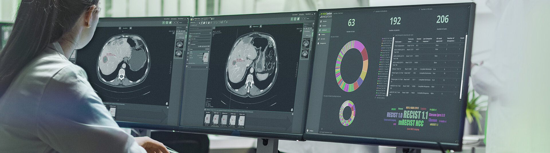 Eine Radiologin führt im Rahmen einer klinischen Studie mit mint Lesion™ eine Mehrfachzeitpunkt-Bewertung eines Leberkrebsfalls durch.