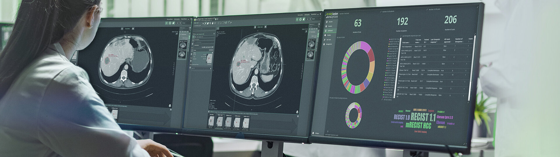 Radiologist performs a tumor response evaluation read in line with iRECIST and analyze the frequency of different criteria used in clinical trials