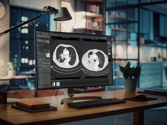 Oncologic imaging: lung cancer screening in mint Lesion