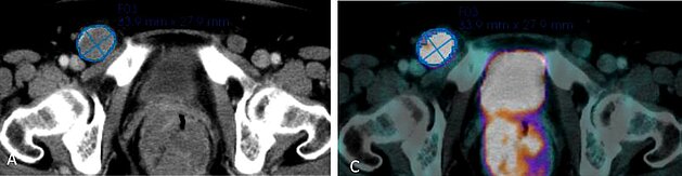 [Translate to German:] 