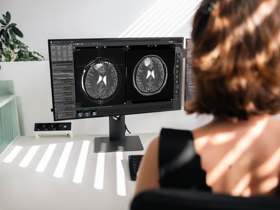 Screenshot of the mint Lesion interface showing RANO 2.0 configuration, tumor burden calculations, and structured neuro-oncology assessment tools.