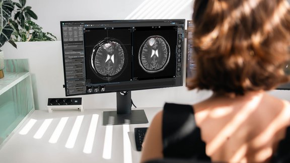 Screenshot of the mint Lesion interface showing RANO 2.0 configuration, tumor burden calculations, and structured neuro-oncology assessment tools.