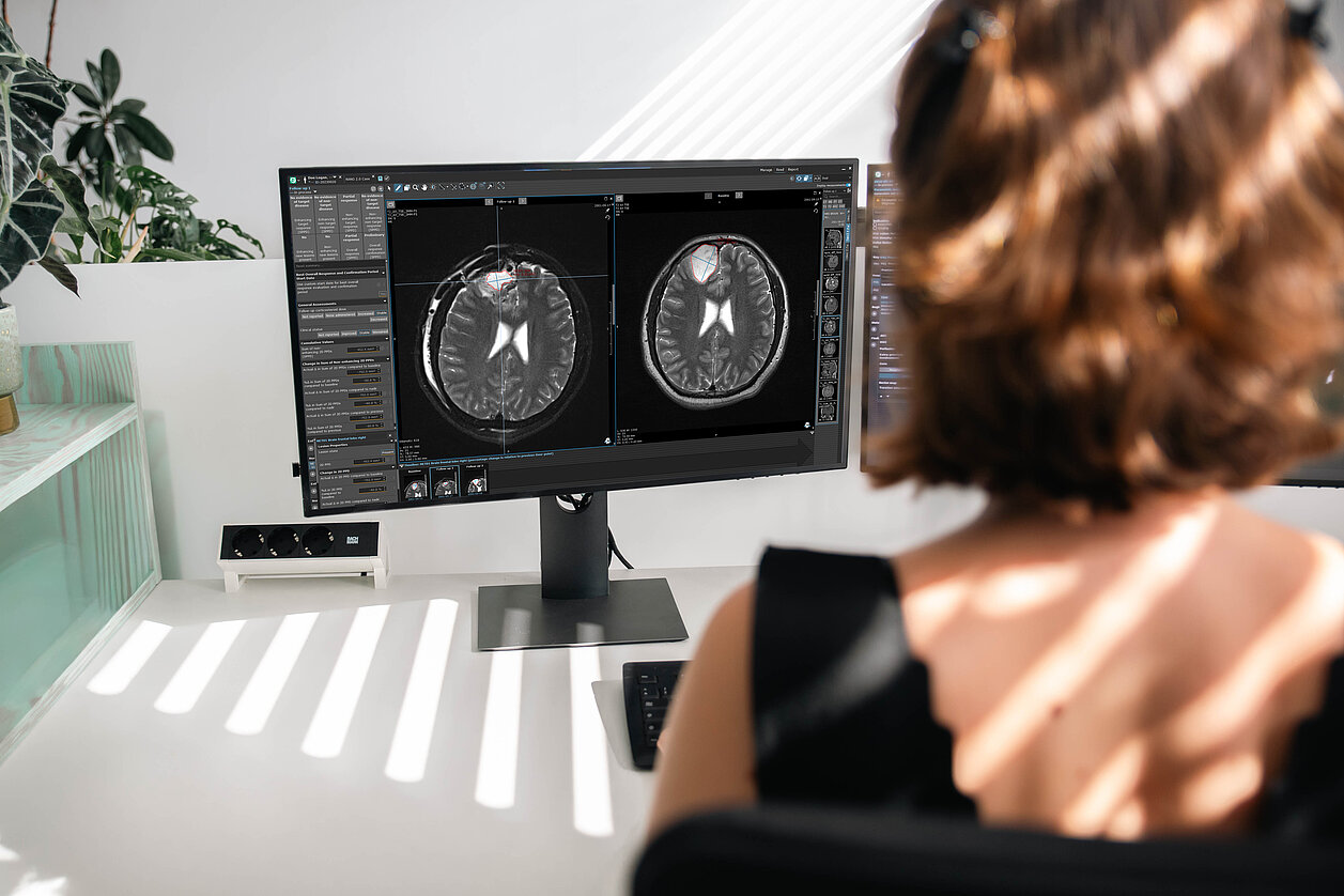 Screenshot der mint-Lesion-Oberfläche mit RANO-2.0-Konfiguration, Tumorburden-Berechnung und strukturierten neuroonkologischen Bewertungstools.