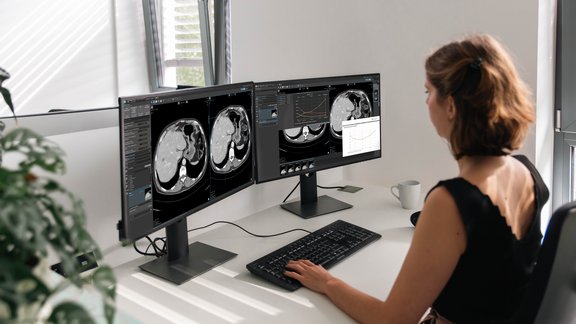 mint Lesion usage during a clinical trial read, featuring the TGRM export tool.