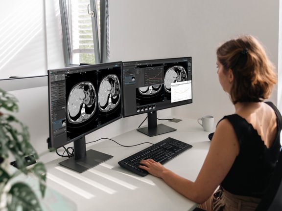 mint Lesion usage during a clinical trial read, featuring the TGRM export tool.