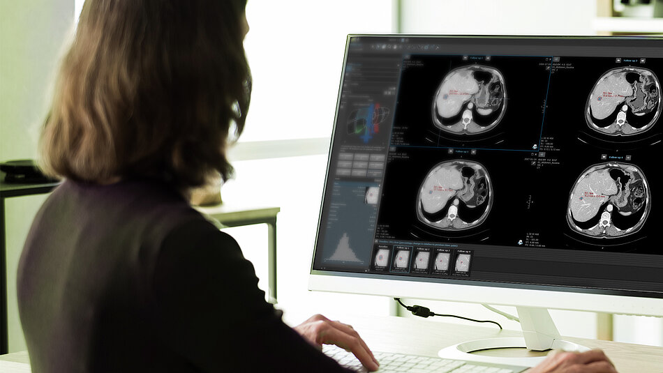 A person is looking at the holistic and structured overview of the clinical trial results in mint Lesion™