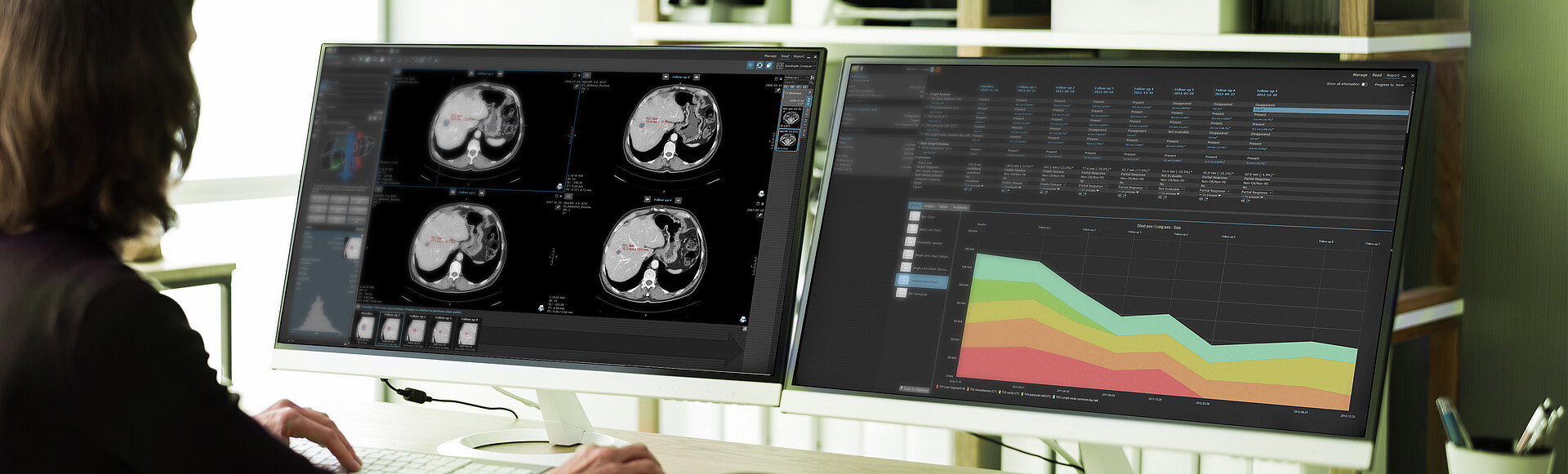 Auswertung von Bilddaten in einer Studie zur Prüfung von Immuntherapeutika im Kontext von iRECIST