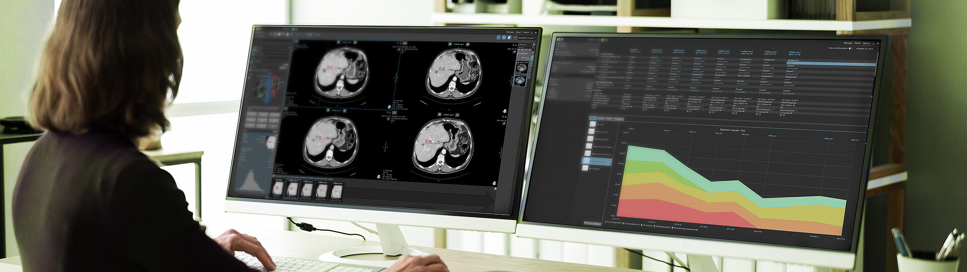 A person is looking at the holistic and structured overview of the clinical trial results in mint Lesion™