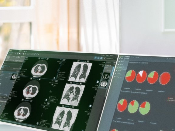 mint Lesion™ DICOM viewer and mint Analytics dashboard