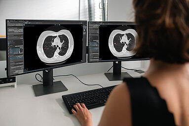 Radiologe nutzt mint Lesion für strukturierte Befundung und KI-gestützte Workflows im Lungenkrebsscreening