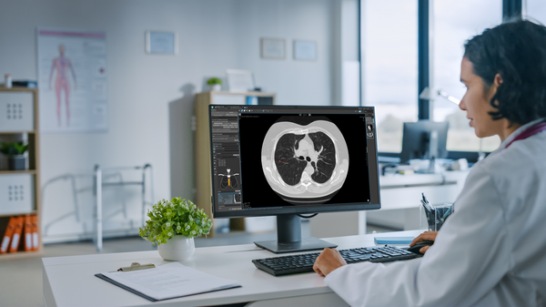 Radiologist looking at MRI image of lung in mint Lesion