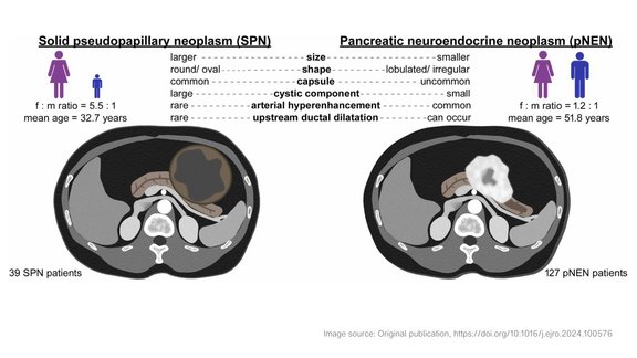 Illustrations of solid pseudopapillary neoplasms and pancreatic neuroendocrine neoplasms