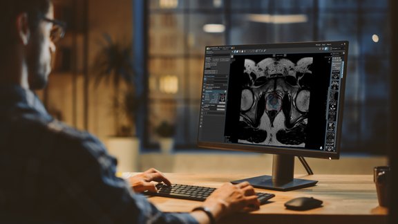 Image of doctor looking at a prostate in mint Lesion.
