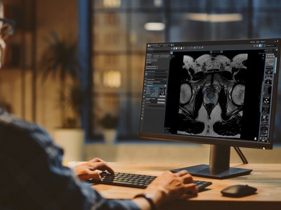 Image of doctor looking at a prostate in mint Lesion.