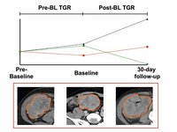 Study Analyzing the Tumor Growth Rate as a Prognostic Biomarker in Lymphoma Patients Under CAR T-Cell Therapy