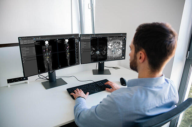 Radiologe analysiert Ganzkörper-MRT-Aufnahmen von Knochenmetastasen beim Prostatakarzinom mit KI-gestützter Tumorlastquantifizierung in mint Lesion