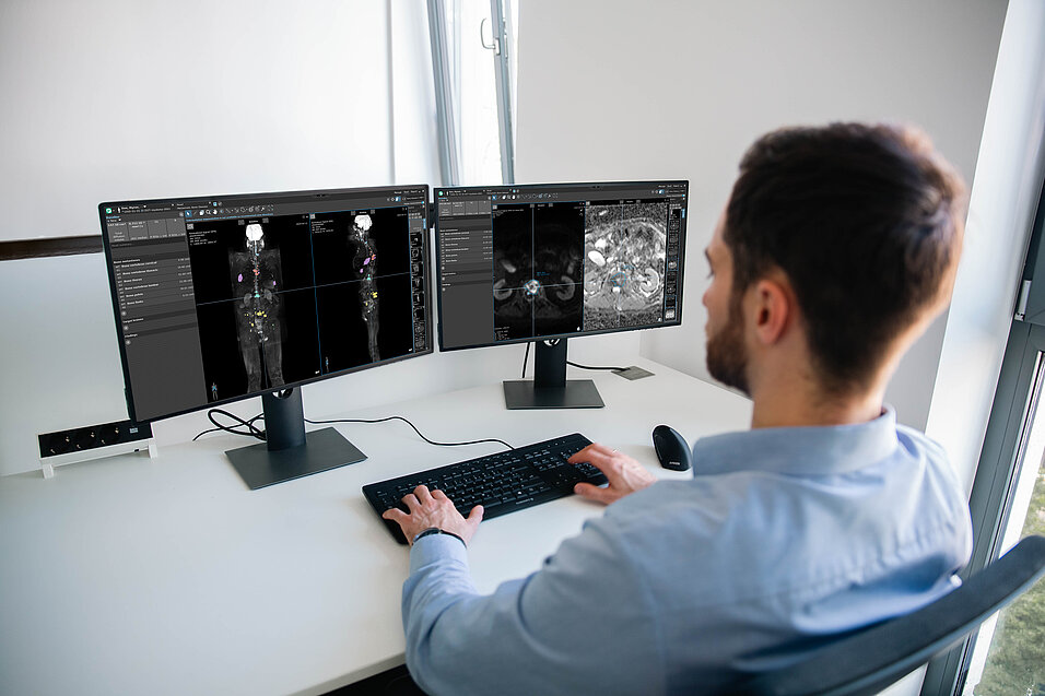 Radiologist using mint Lesion for whole-body MRI assessment in multiple myeloma