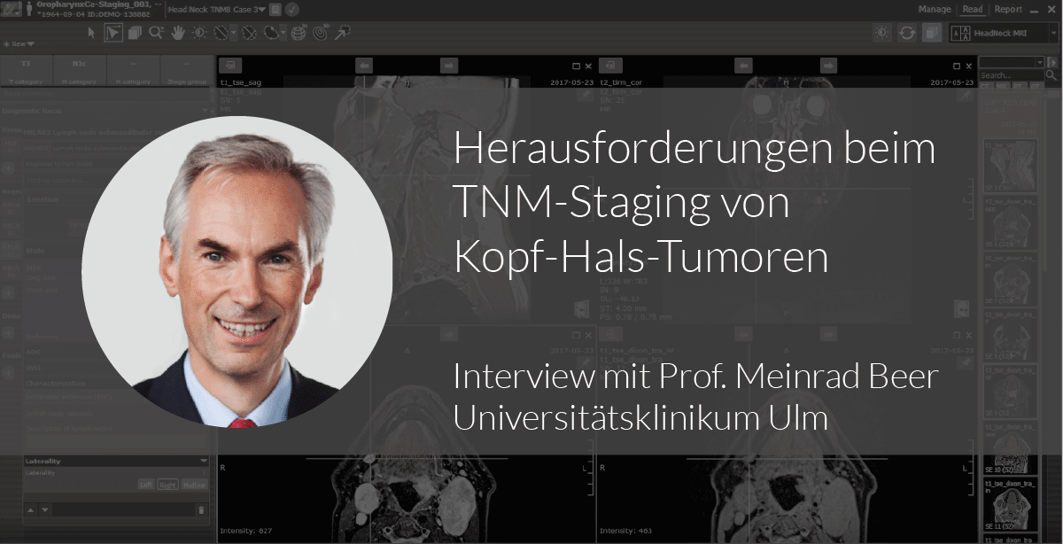 Herausforderungen beim Staging von Kopf-Hals-Tumoren - Interview mit ...