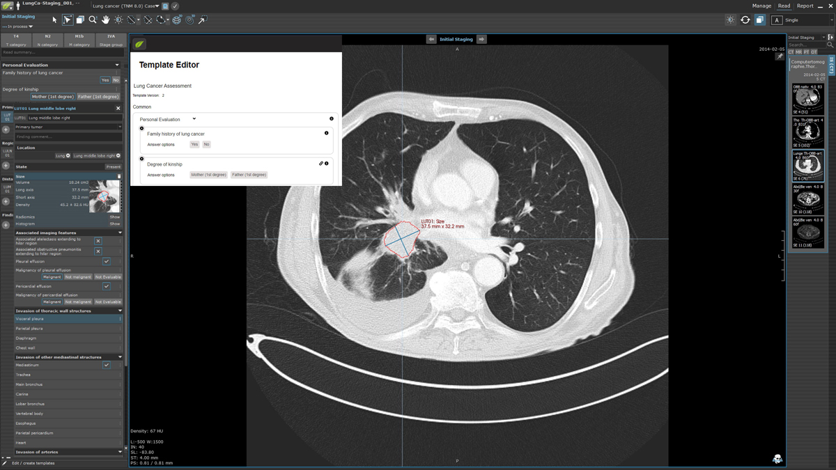 Customizing structured data collection with mint Lesion™ Template